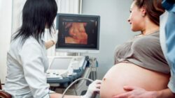 a woman having a 3d ultrasound scan
