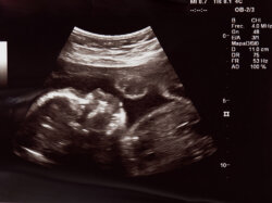Baby scan for University of Barcelona research.